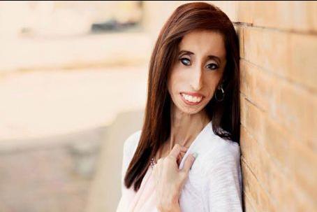 Lizzie Velásquez Death Fact Check, Birthday & Age | Dead or Kicking