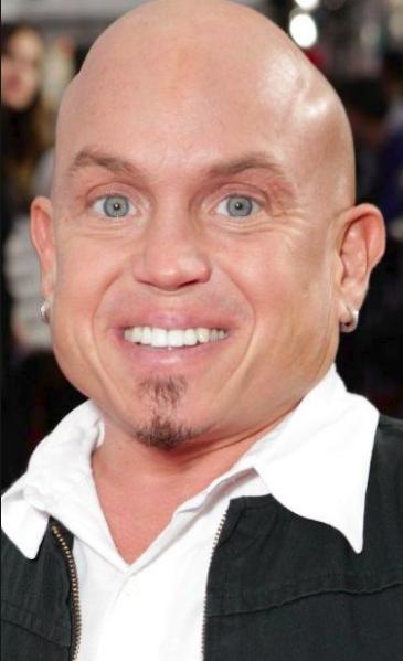 Martin Klebba Death Fact Check, Birthday & Age | Dead or Kicking